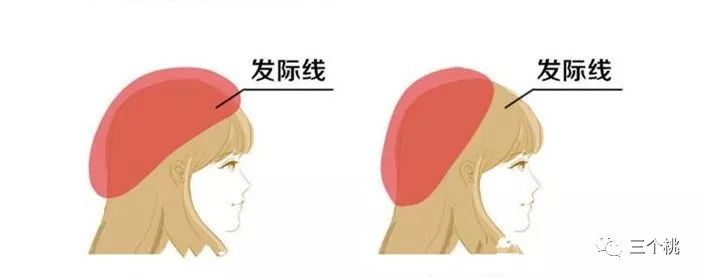 贝雷帽的戴法怎么固定好看,头大软边贝雷帽正确戴法