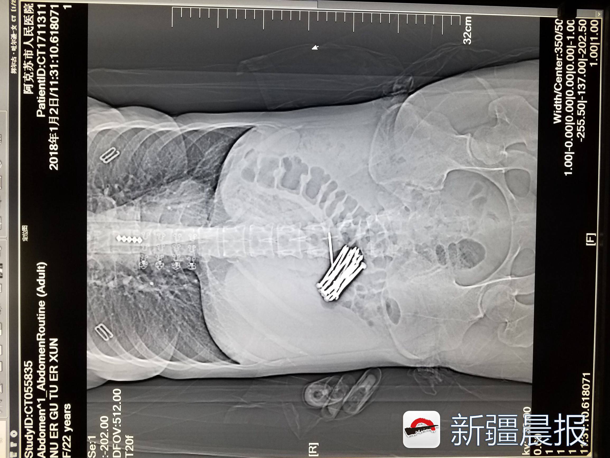 晨看*疆新**│我区47个火车站可办会员；*疆新**电影票房十年增长近十倍