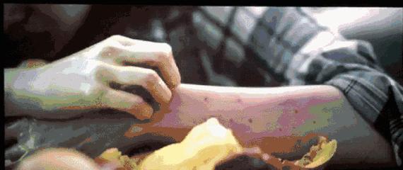 林佳含泪吃芒果过敏图片,前任林佳吃芒果过敏片段