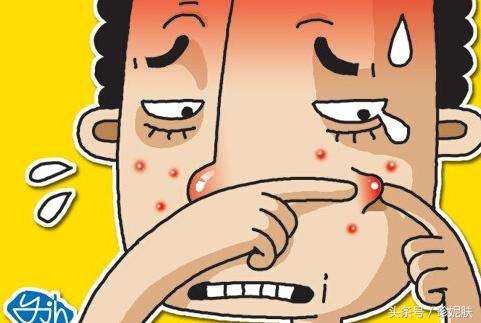 痘印持久不消用什么最好,痘印久久不消是怎么回事