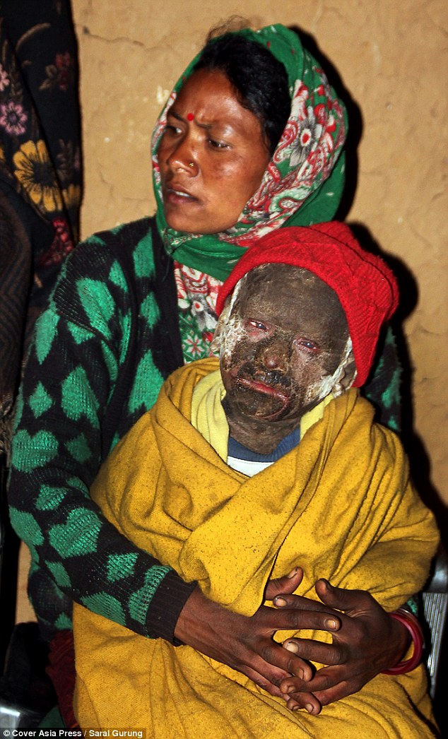 小男孩一出生无鼻无耳无眼,小男孩一出生奇丑无比