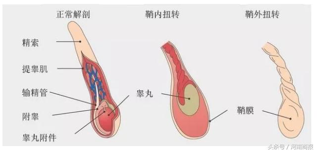郑州一男童“蛋蛋”疼,送医后为时已晚需要切除!