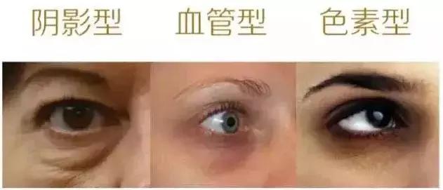 最强遮瑕黑眼圈,最强遮斑遮瑕