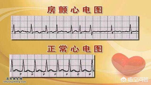 风心病出现房颤怎么办,房颤该怎么办