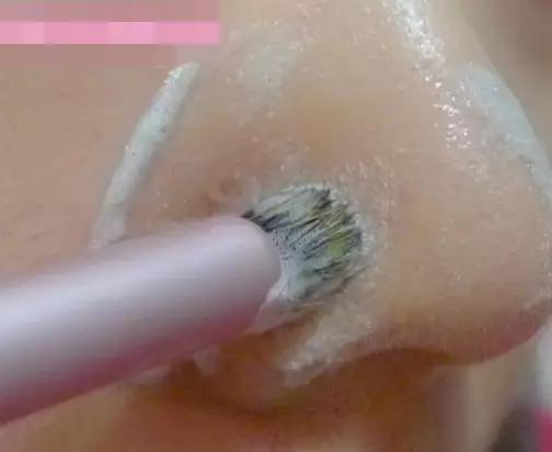 去黑头最彻底的偏方小妙招,去黑头的最好方法妙招科普