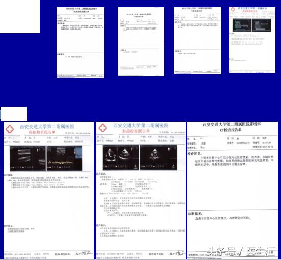 年轻高血压患者的降压方案,青年高血压要怎么吃降压药