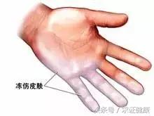 应对严寒的方式,应对低温