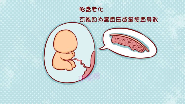 孕妈妈胎盘能成熟更快一些,胎盘成熟了胎儿才会发动吗