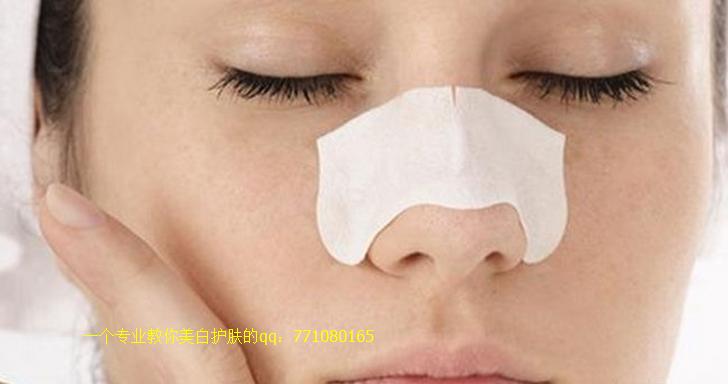 白头粉刺怎么去除鼻子脸颊,白头粉刺怎么去除背部