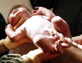 细数剖腹产对产妇和宝宝的13大危害！原来剖腹产才会阴道松弛！