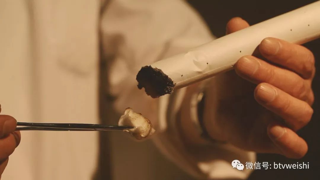 贺氏针灸养生堂视频全集,贺氏针灸养生堂