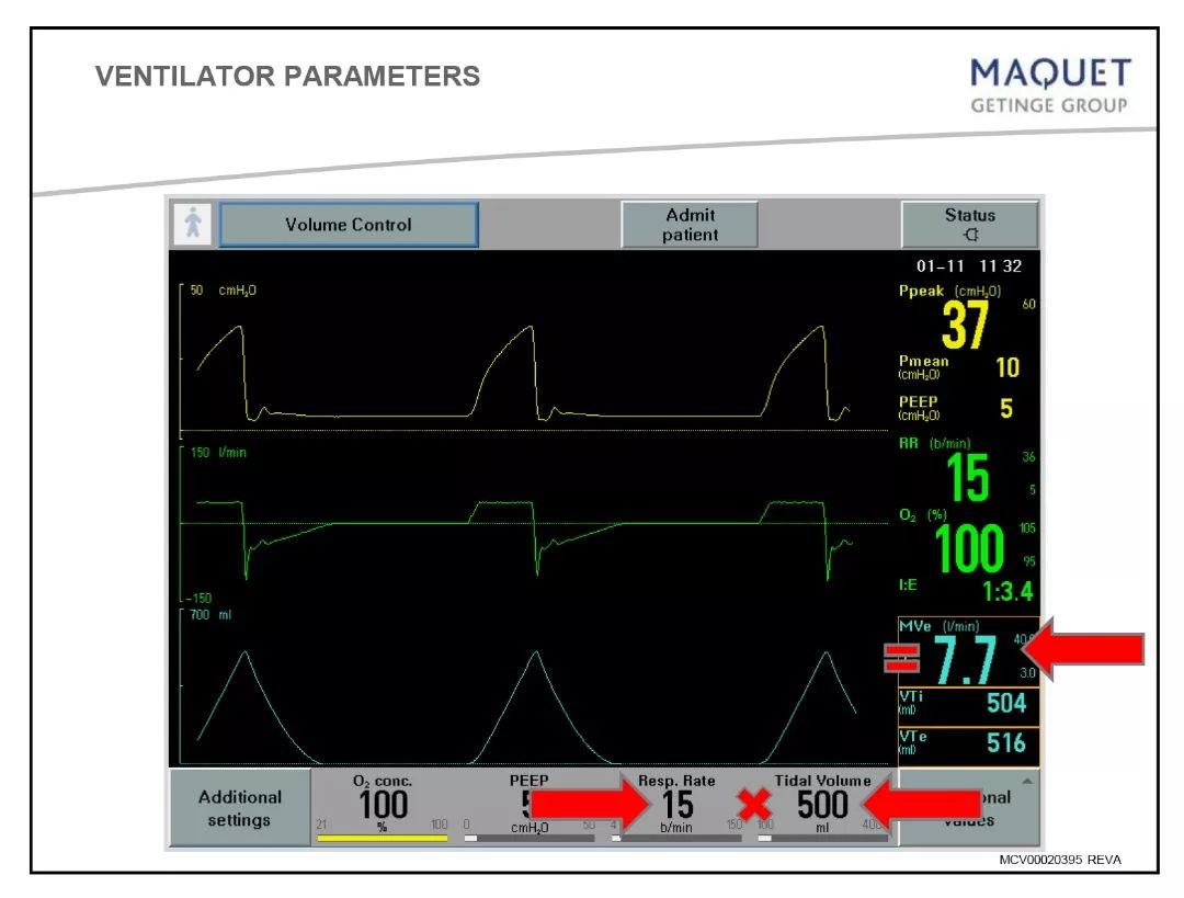 呼吸机基础知识最终版,呼吸机临床设置方法