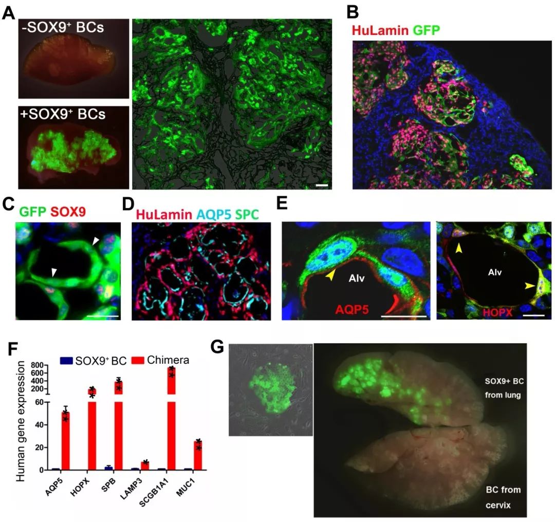 人类干细胞重造动物器官,人类首次肺脏再生是哪一年
