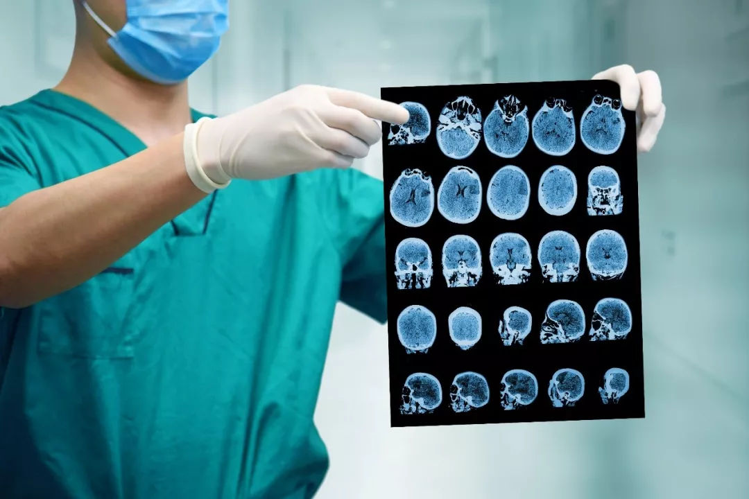 最强大脑22岁的女孩,最强大脑12岁女孩