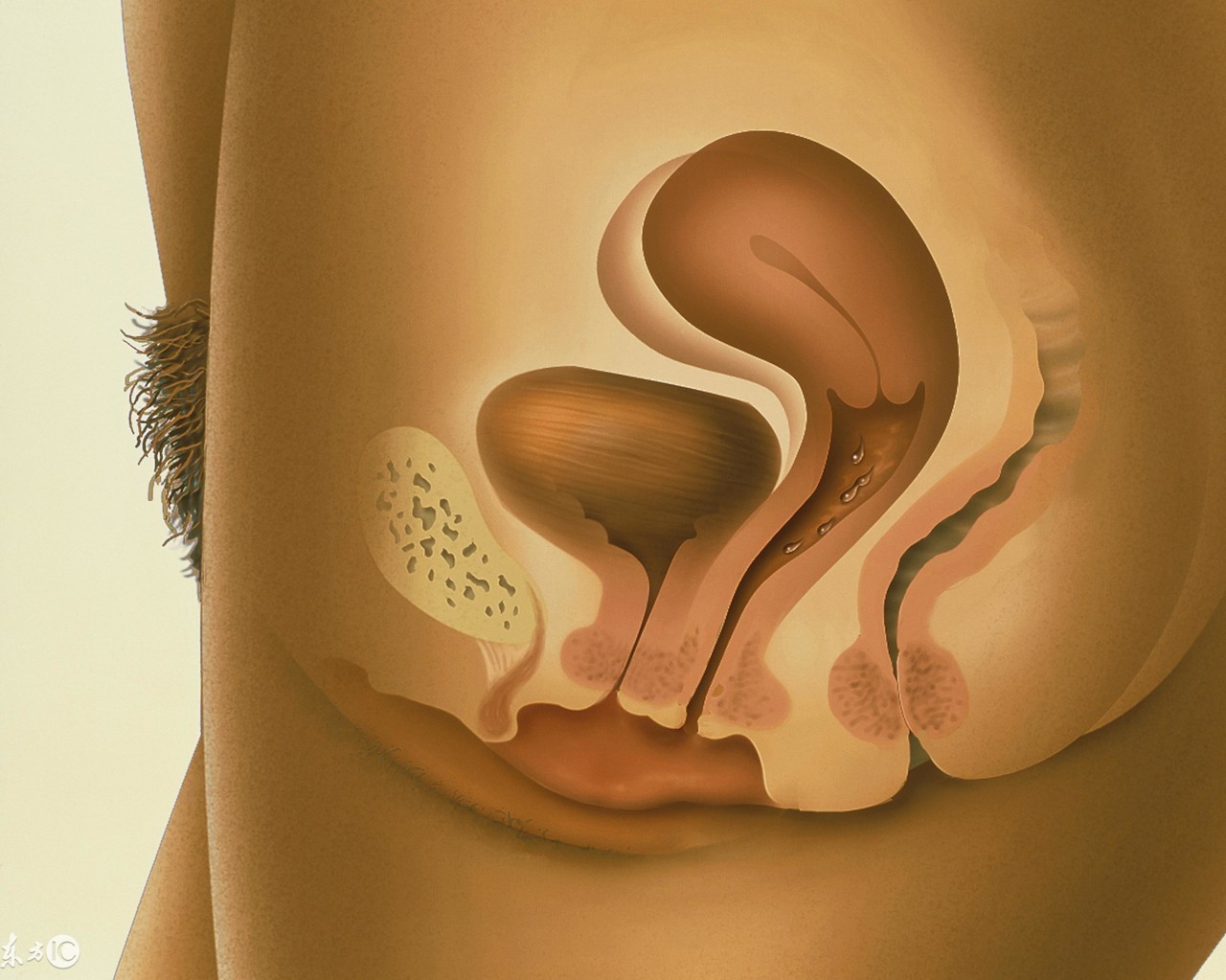 哪些疾病需要切子宫,女性什么疾病需要切子宫