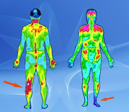 扎“火针”治宫颈糜烂？从先秦流传下来的火针疗法究竟是啥？