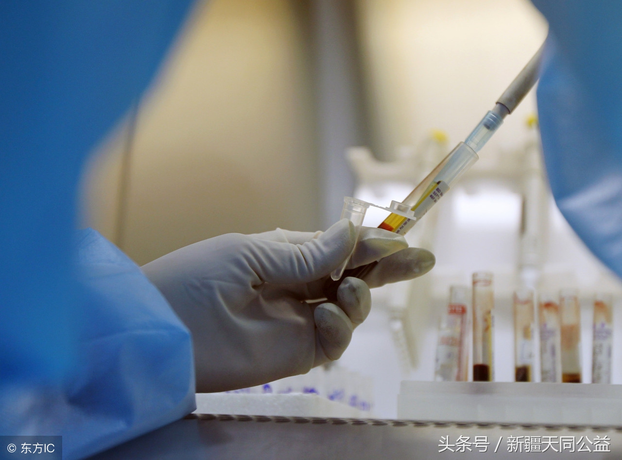 「HIV」艾滋的20大迷思