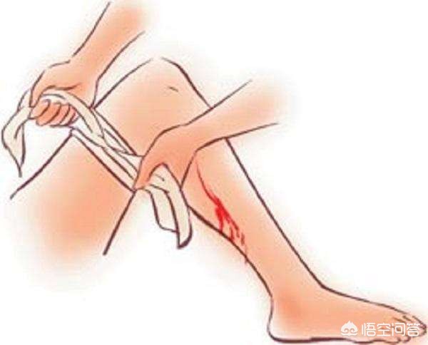 燃放烟花爆竹的防火措施,燃放烟花爆竹如何注意安全