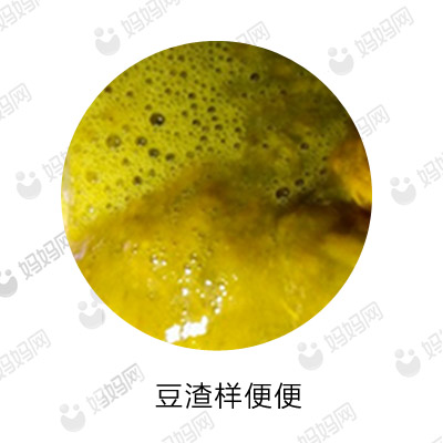 宝宝拉这几种便便要去医院,宝宝有问题的便便是怎样的