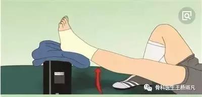 侧副韧带前叉断裂康复训练,前叉交叉韧带重建后多久能脱拐