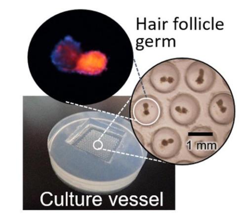 目前最先进的毛囊再生技术,秃头快速生发