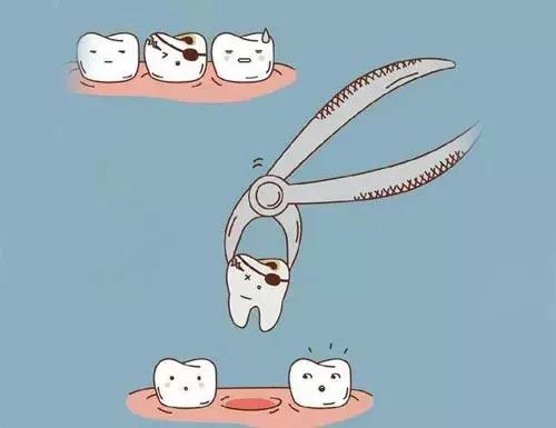 关于牙齿你有哪些疑问呢,关于牙齿的疑问