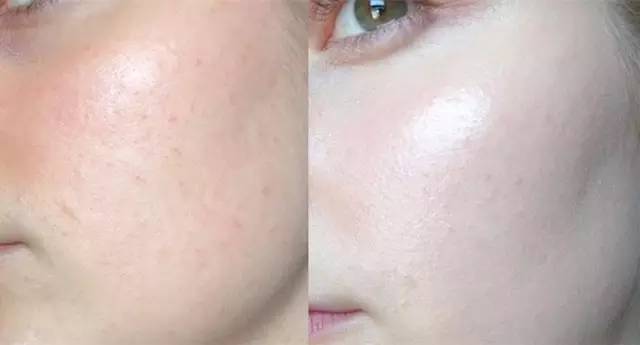 适合男朋友的粉底,选合适自己的粉底