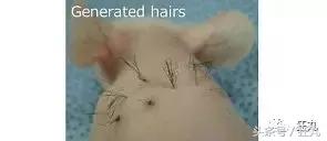 麦当劳薯条治疗脱发,麦当劳薯条掉头发