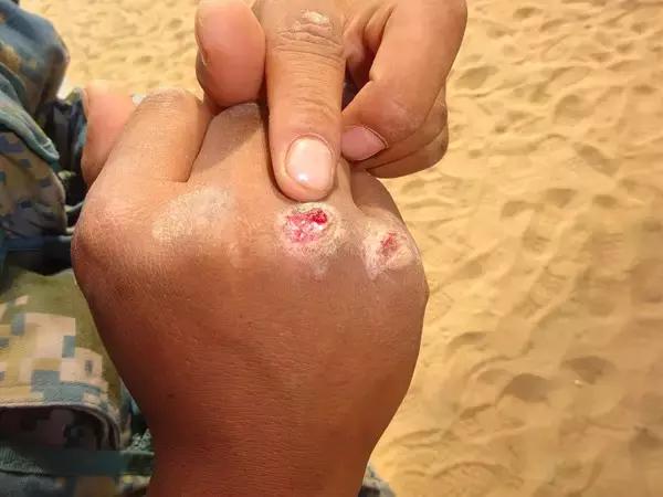 部队比赛拿奖怎么发朋友圈,部队士兵得奖怎么发朋友圈