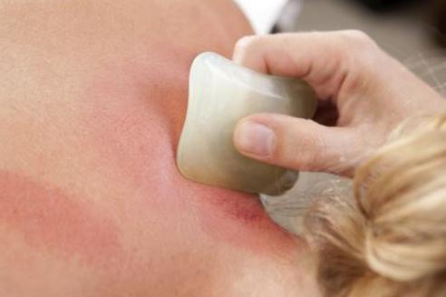 感冒喉咙痛刮痧刮哪个部位呢,感冒流清鼻涕刮痧刮哪里图解