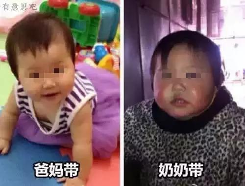 宝宝红苹果脸怎么消除,宝宝脸干又变黑怎么办