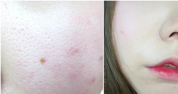 比阿玛尼红标还好用的粉底液,阿玛尼兰蔻ysl粉底液测评