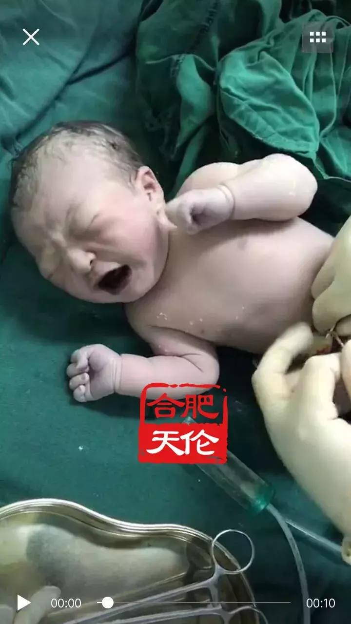 苦尽甘来！曾因为卵巢瘤切除一侧卵巢的她顺利当妈了！