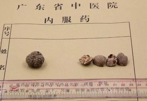 白豆蔻草豆蔻肉豆蔻各是什么功效,草豆蔻与白豆蔻肉豆蔻的功效区别