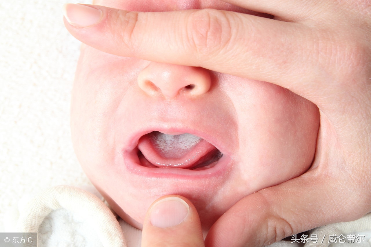 六个月宝宝内火过剩,一个多月的宝宝内火重怎么办