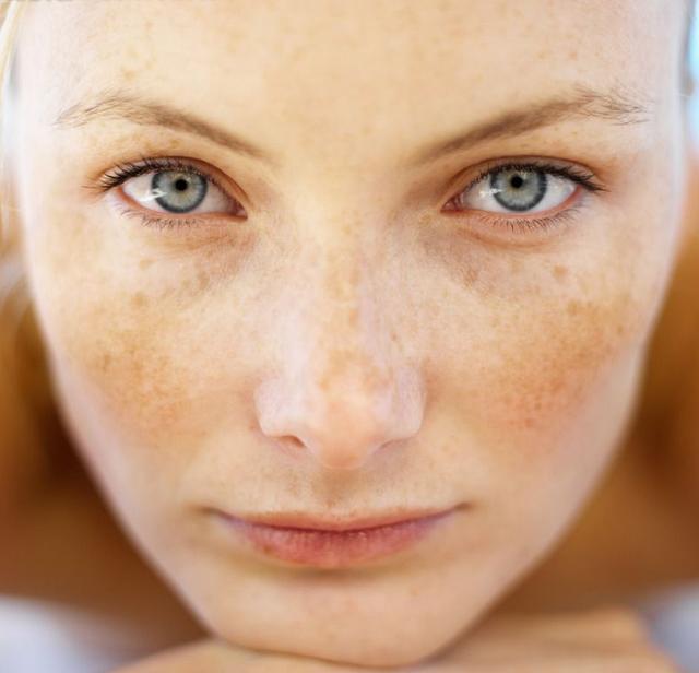 只需学会这几招,多年的色斑都消失了,只可惜没什么人会用
