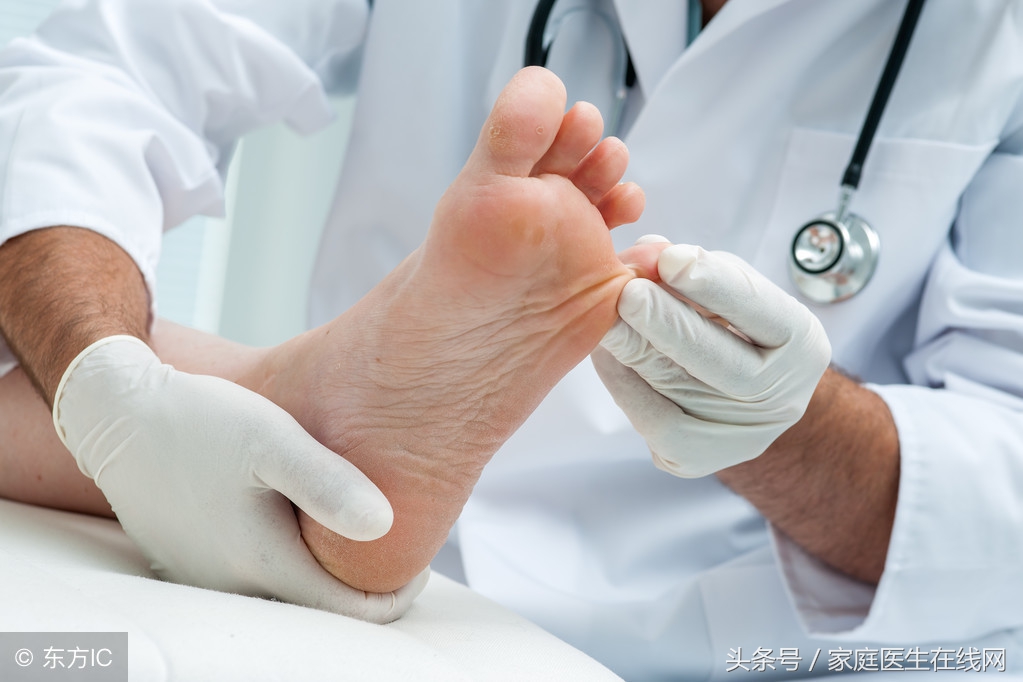 脚气能根除吗严重的脚气怎么治疗,日本脚气水可以根治脚气嘛