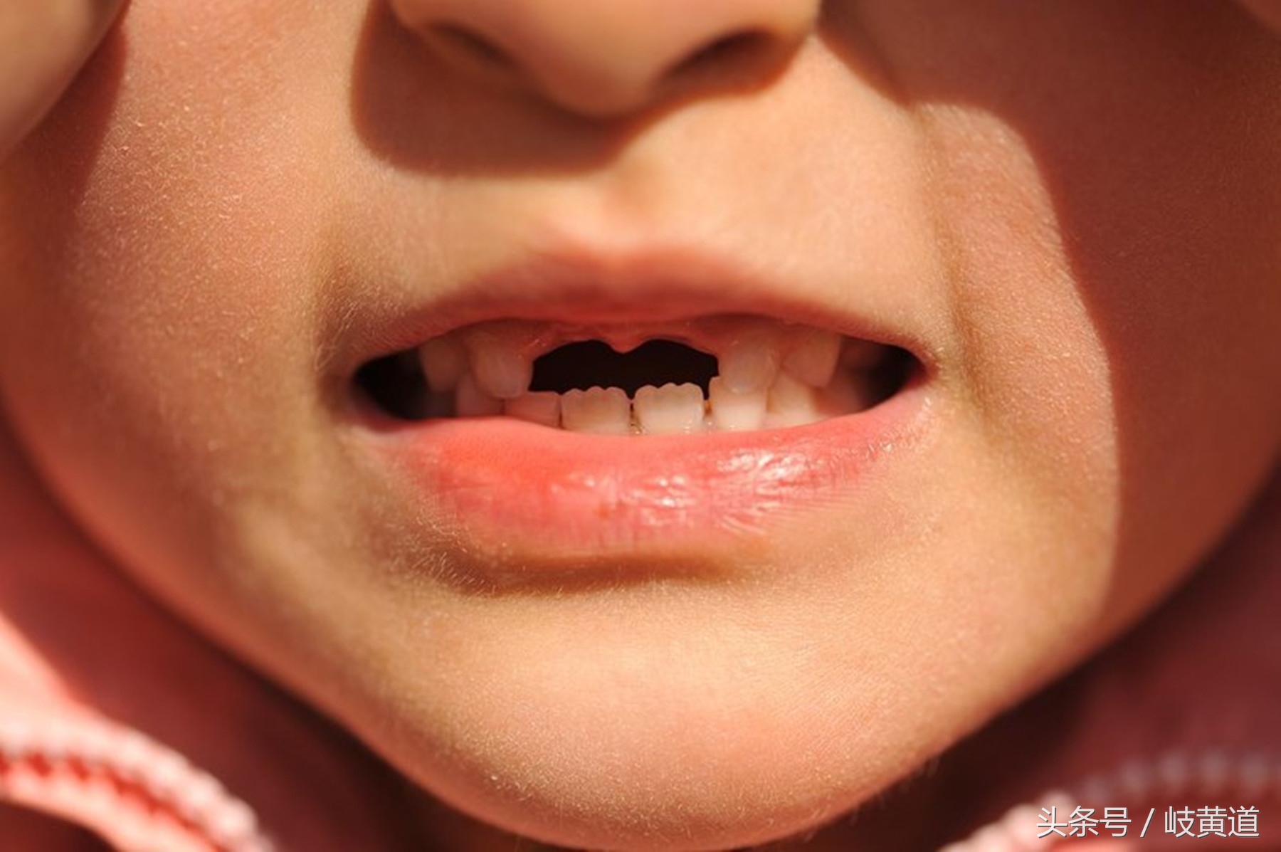 宝宝乳牙没掉又长新牙什么原因,宝宝乳牙没掉长出新牙怎么办