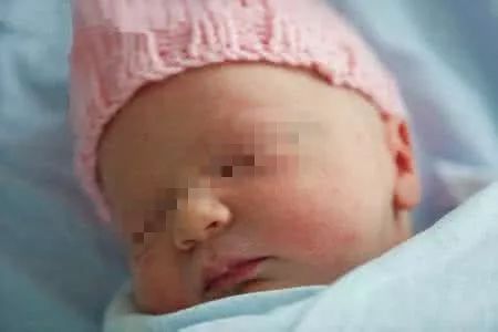 春风一起，怎么娃儿的皮肤就变粗糙了？面部还经常出红疹？