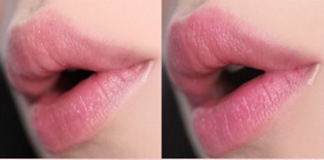 寰晢鍙g孩鐖嗘,涓嵂鎴愬垎鐨勬姢鑲ゅ搧寰晢