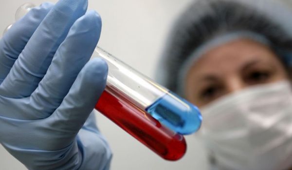 尿酸日常怎么降下来,尿酸降下来了以后该注意些什么