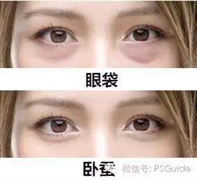 什么是卧蚕在脸上呢,卧蚕和眼袋的区别