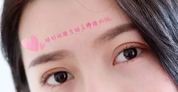 内双如何自然地变成双眼皮?