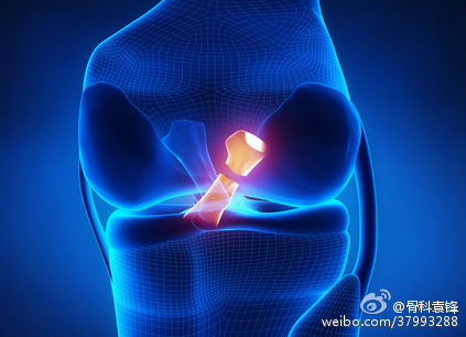 如何正确对待前交叉韧带损伤,前交叉韧带损伤要注意什么