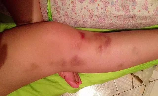 一团暴烈炽热的花火-足球运动员何昕芮|代言云南最大足球赛事！