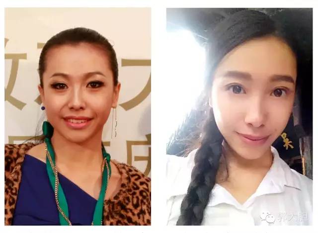 第一次整容日记,整容日记最经典的一段