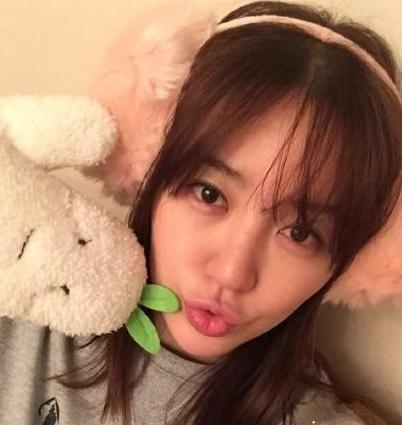 平行双眼皮割成了欧式双眼皮,割了个欧式双眼皮