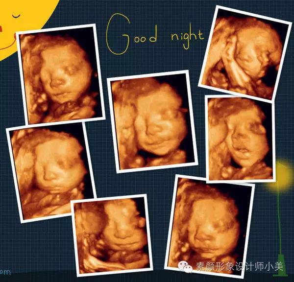 孕育知识大讲堂,怀孕九周怎么知道胎儿发育情况