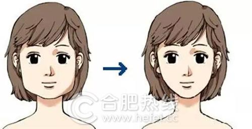 韩美瘦脸针50还是100,韩美注射瘦脸针怎么样