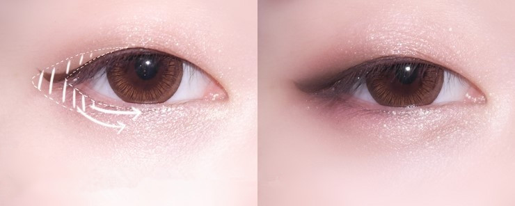 怎么不整容内双变成外双,不用整容缩小鼻头